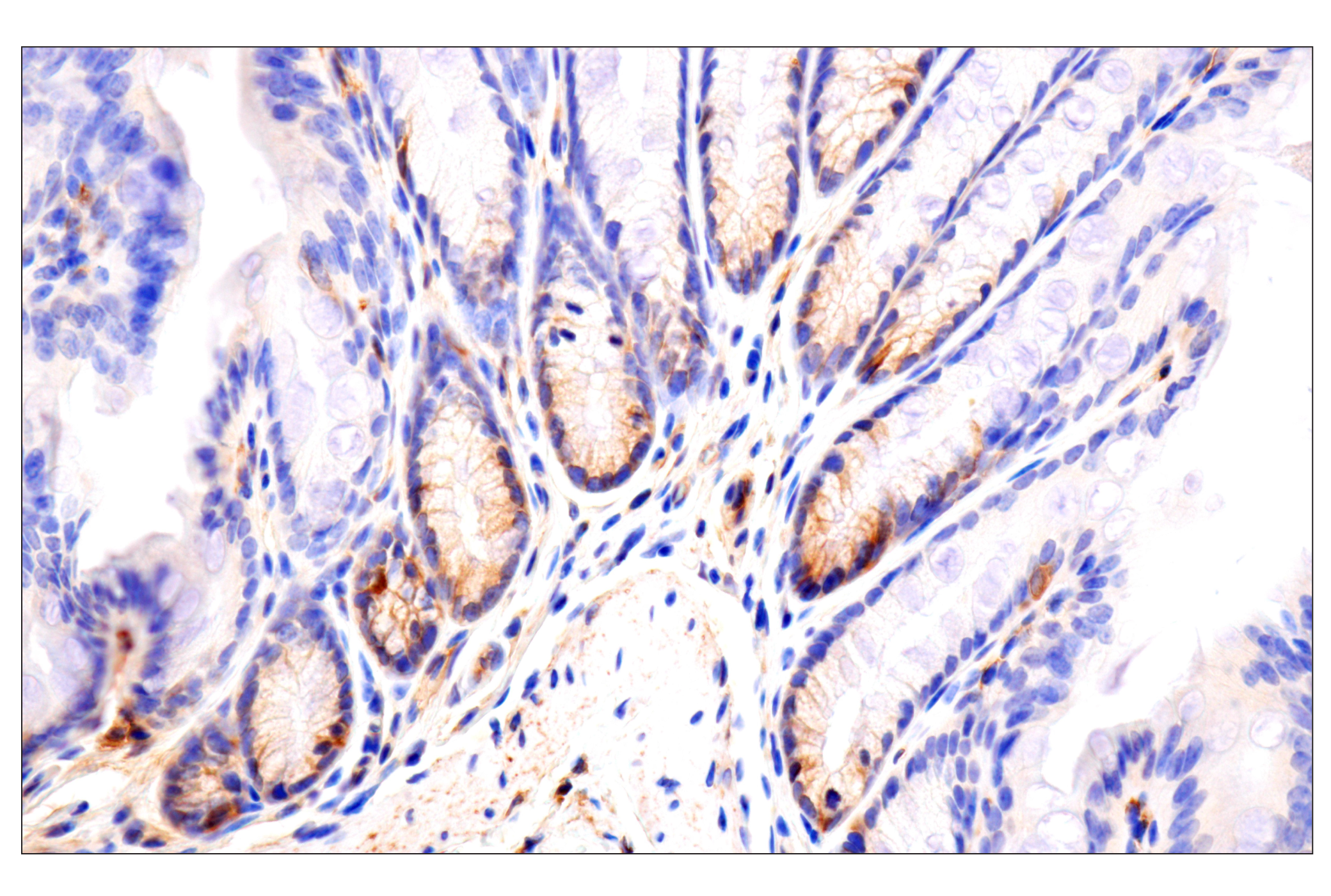 Immunohistochemistry Image 7: CD81 (D5O2Q) Rabbit mAb (BSA and Azide Free)