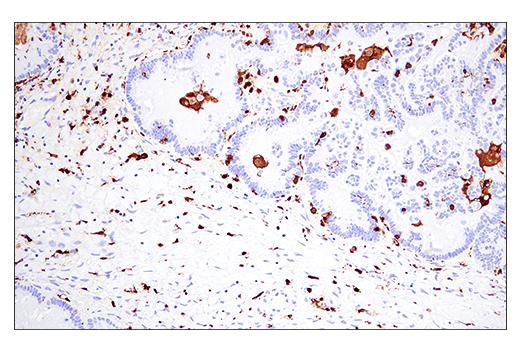 Immunohistochemistry Image 7: Iba1/AIF-1 (E4O4W) XP® Rabbit mAb (BSA and Azide Free)