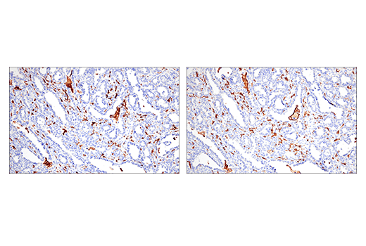 Immunohistochemistry Image 3: Iba1/AIF-1 (E4O4W) XP® Rabbit mAb (BSA and Azide Free)