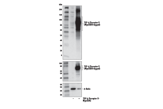 Western Blotting Image 2: TGF-β Receptor II Antibody