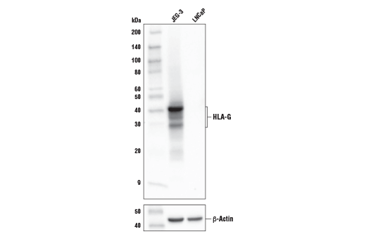  Image 12: MHC Class I Antigen Processing and Presentation Antibody Sampler Kit