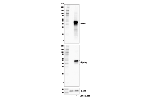  Image 20: MHC Class I Antigen Processing and Presentation Antibody Sampler Kit