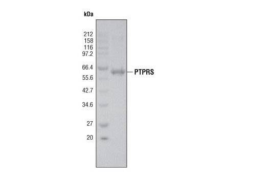  Image 2: PTPRS Phosphatase