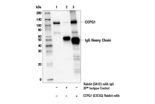 Immunoprecipitation Image 1: CCPG1 (E3C5G) Rabbit mAb