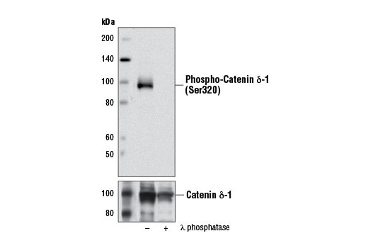 Western Blotting Image 1: Phospho-Catenin δ-1 (Ser320) Antibody