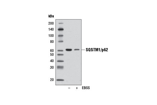  Image 24: Mitophagy Antibody Sampler Kit