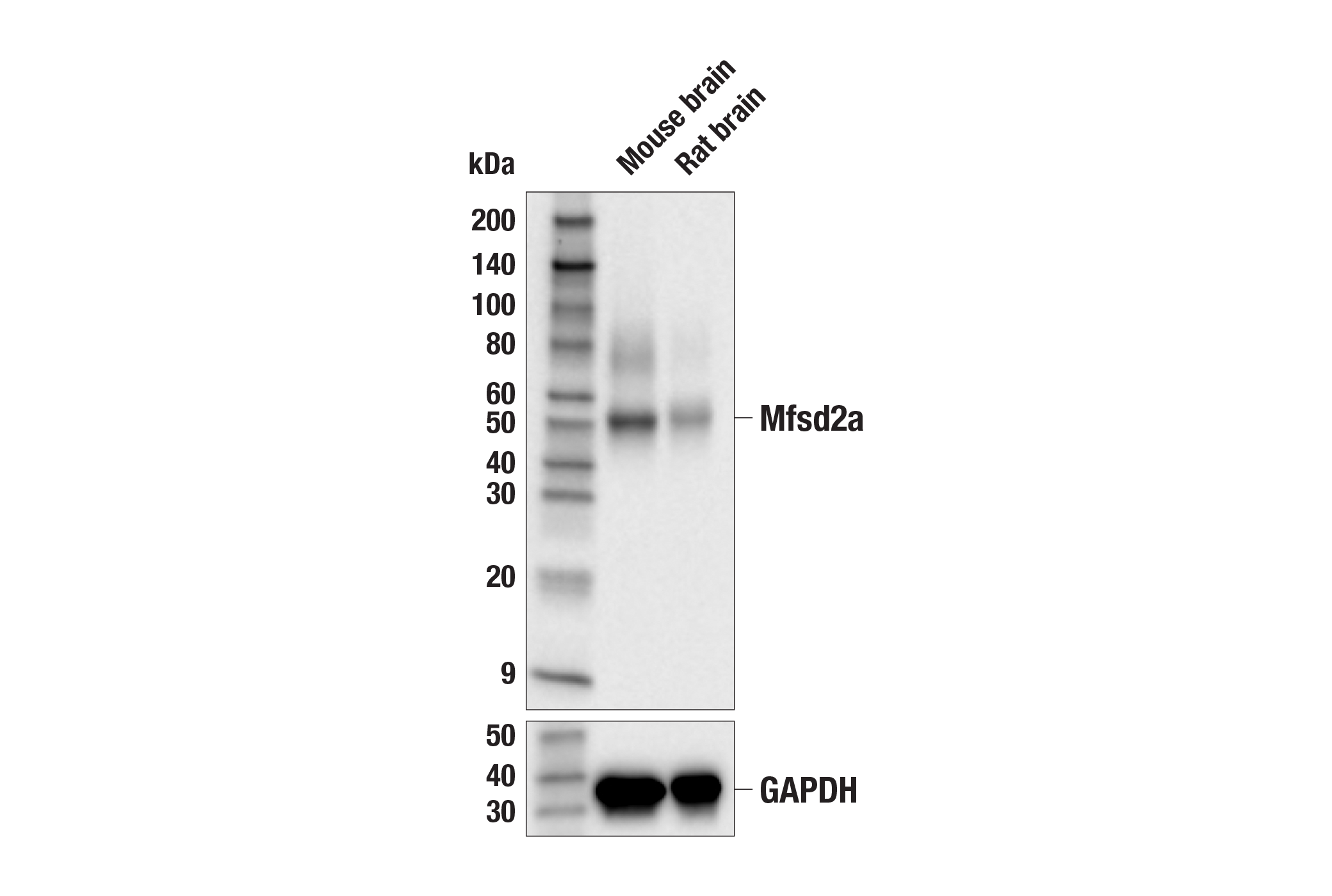 Western Blotting Image 1: Mfsd2a (E8U2O) Rabbit mAb