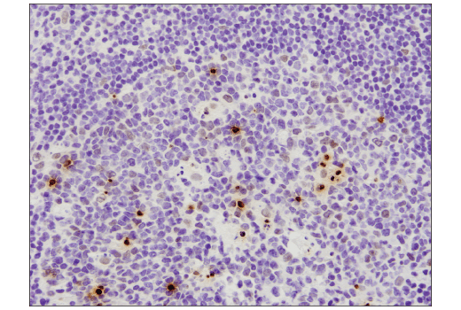 Immunohistochemistry Image 6: Phospho-Histone H2A.X (Ser139) (D7T2V) Mouse mAb