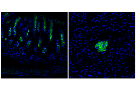 Immunofluorescence Image 1: BACE2 (E3Y9Q) Rabbit mAb