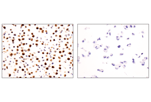 Immunohistochemistry Image 1: Syk (4D10) Mouse mAb