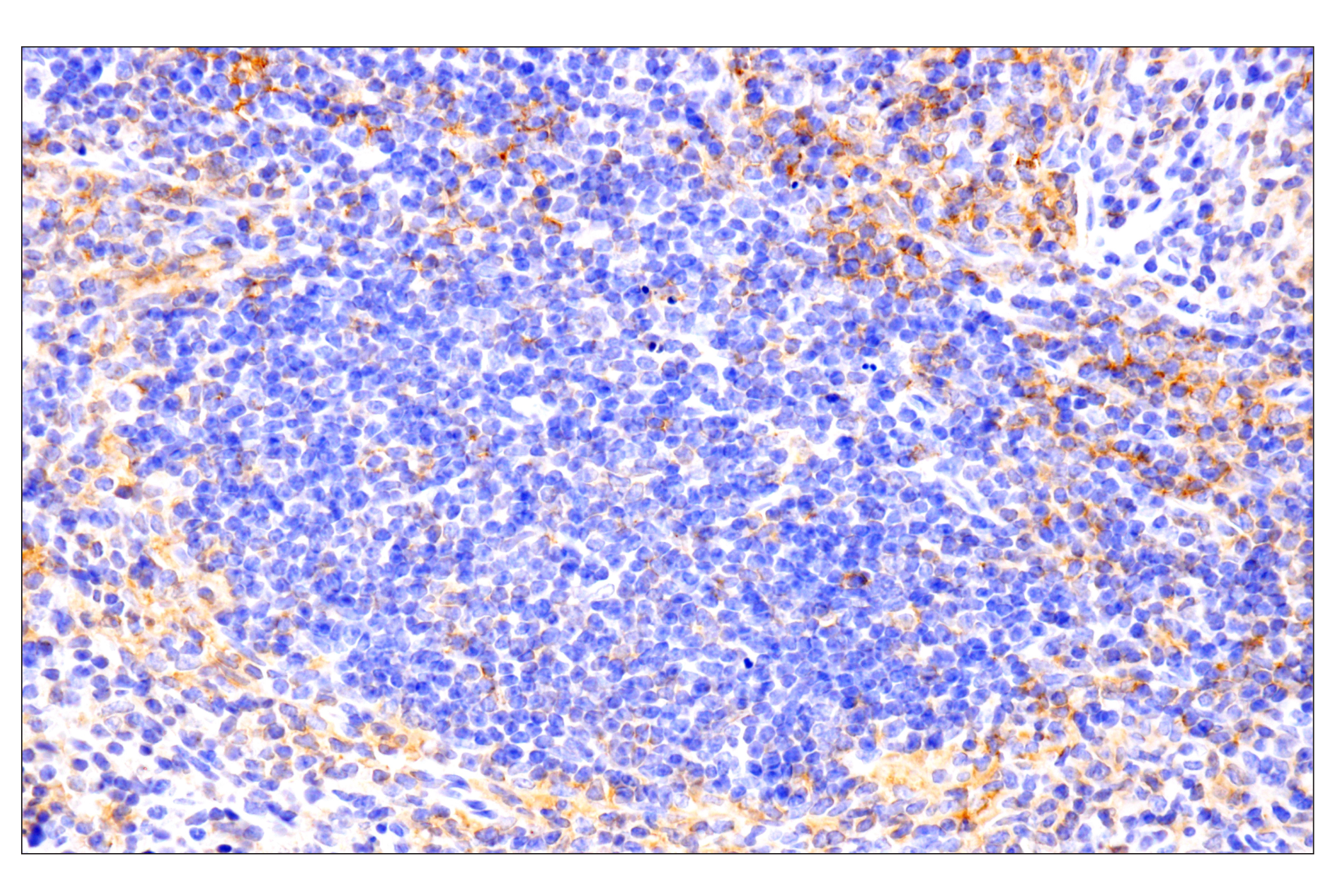 Immunohistochemistry Image 3: PD-L1 (F3Z1T) Rabbit mAb (IHC Formulated)
