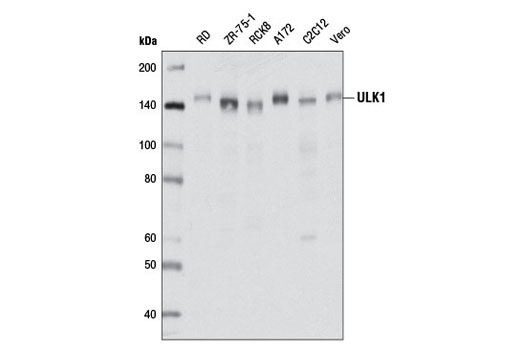  Image 14: Autophagy Induction (ULK1 Complex) Antibody Sampler Kit