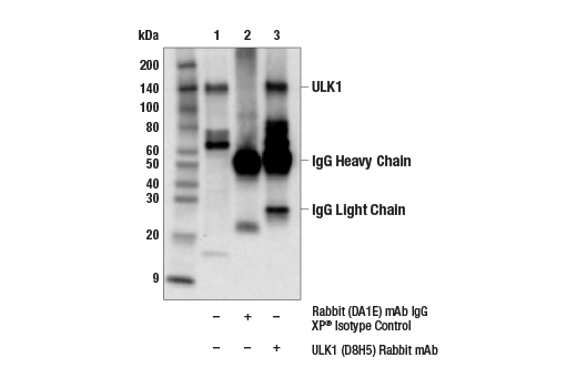  Image 1: ULK1 Antibody Sampler Kit