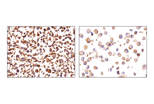 Immunohistochemistry Image 1: ASCT2 (D7C12) Rabbit mAb