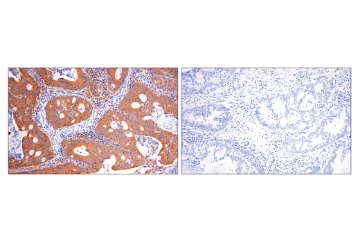 Immunohistochemistry Image 3: Rab5A (E6N8S) Mouse mAb (BSA and Azide Free)