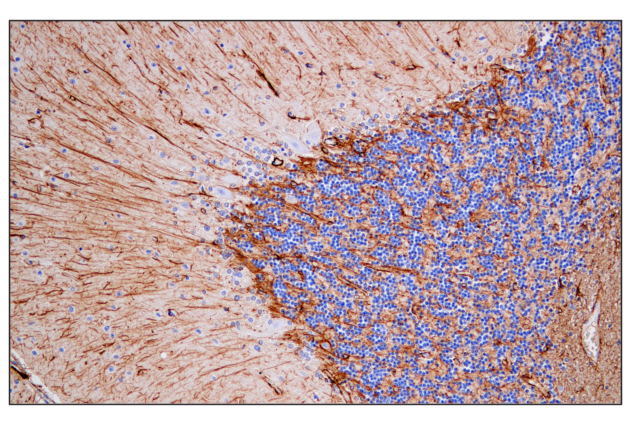  Image 2: Astrocyte Markers Antibody Sampler Kit
