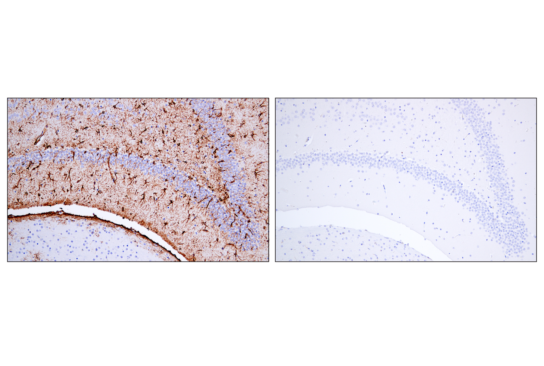  Image 38: Astrocyte Markers Antibody Sampler Kit