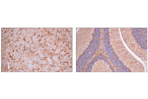  Image 37: Astrocyte Markers Antibody Sampler Kit