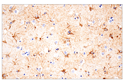  Image 11: Astrocyte Markers Antibody Sampler Kit