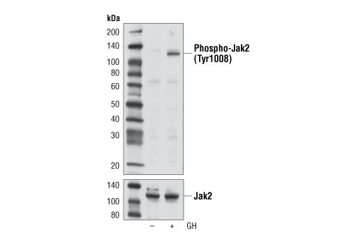  Image 17: Phospho-Jak Family Antibody Sampler Kit