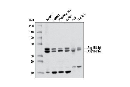  Image 5: PhosphoPlus® Atg16L1 (Ser278) Antibody Duet