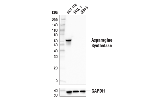 Western Blotting Image 2: Asparagine Synthetase (E6C2C) XP® Rabbit mAb (BSA and Azide Free)