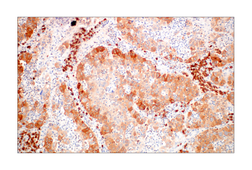 Immunohistochemistry Image 1: Asparagine Synthetase (E6C2C) XP® Rabbit mAb (BSA and Azide Free)