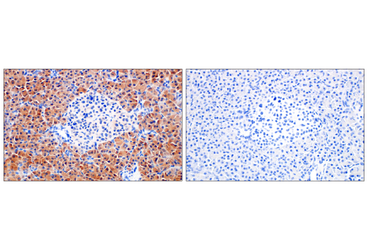 Immunohistochemistry Image 8: Asparagine Synthetase (E6C2C) XP® Rabbit mAb (BSA and Azide Free)