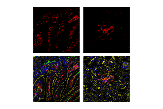 Immunofluorescence Image 1: CD45 (D3F8Q) Rabbit mAb (Alexa Fluor® 647 Conjugate)