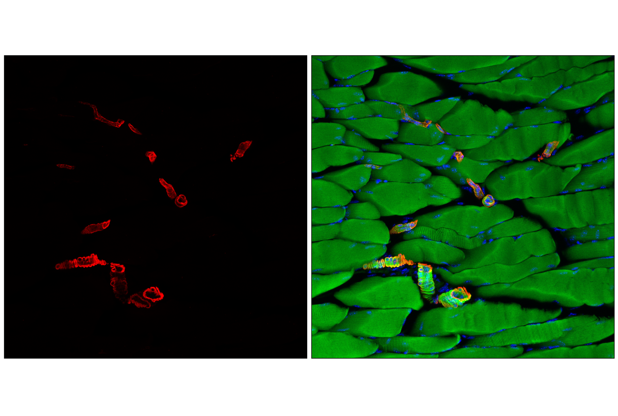 Immunofluorescence Image 2: α-Smooth Muscle Actin (D4K9N) XP® Rabbit mAb (Alexa Fluor® 700 Conjugate)