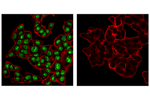 Immunofluorescence Image 1: ADAR1 (E6X9R) XP® Rabbit mAb