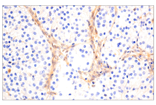 Immunohistochemistry Image 3: VHL (E3X9K) Rabbit mAb