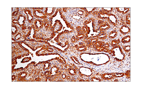 Immunohistochemistry Image 7: RIP (E8S7U) XP® Rabbit mAb (BSA and Azide Free)