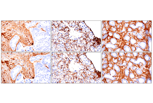 Immunohistochemistry Image 9: COL1A1 (E8F4L) XP® Rabbit mAb (BSA and Azide Free)