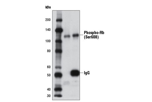 Immunoprecipitation Image 1: Phospho-Rb (Ser608) (D10F2) Rabbit mAb