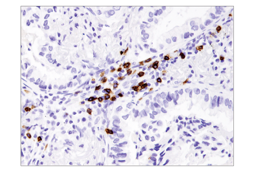 Immunohistochemistry Image 2: CD8α (D8A8Y) Rabbit mAb (BSA and Azide Free)
