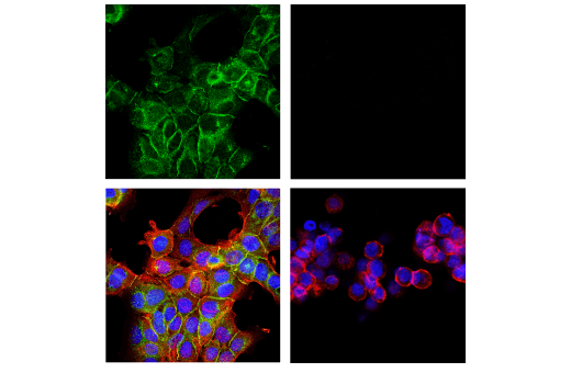 Immunofluorescence Image 1: CD151 (E9M8T) Rabbit mAb