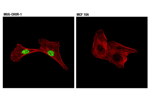 Immunofluorescence Image 1: Brachyury (D2Z3J) Rabbit mAb