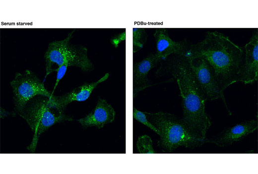 Immunofluorescence Image 1: PKD2 (D1A7) Rabbit mAb