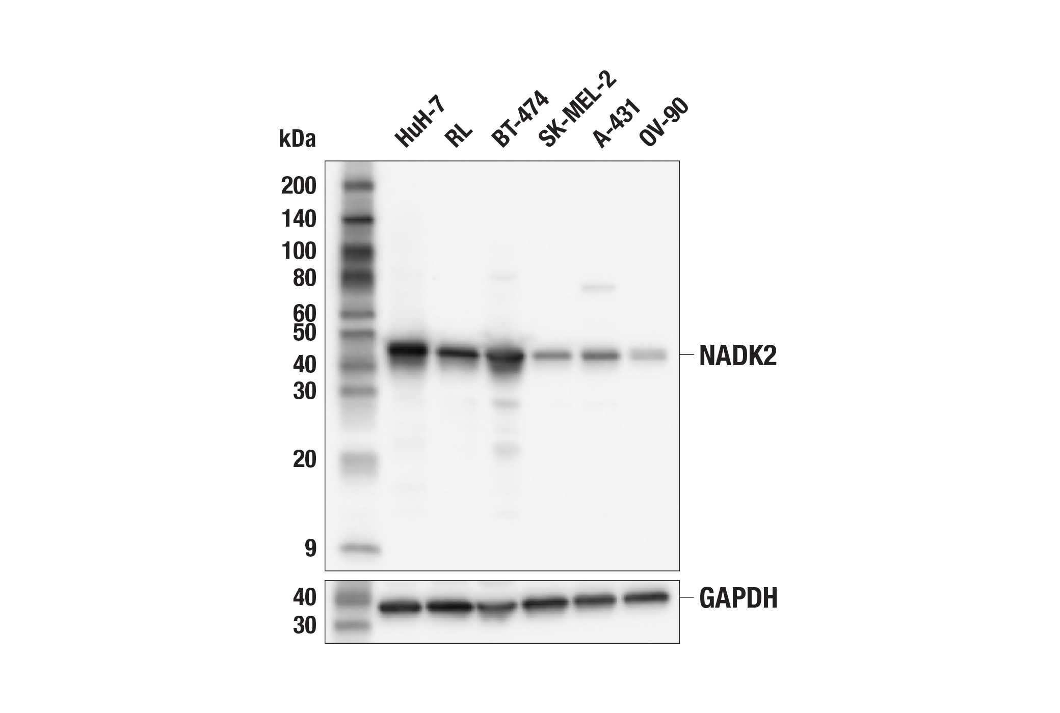 Western Blotting Image 1: NADK2 (F5X1V) Rabbit mAb