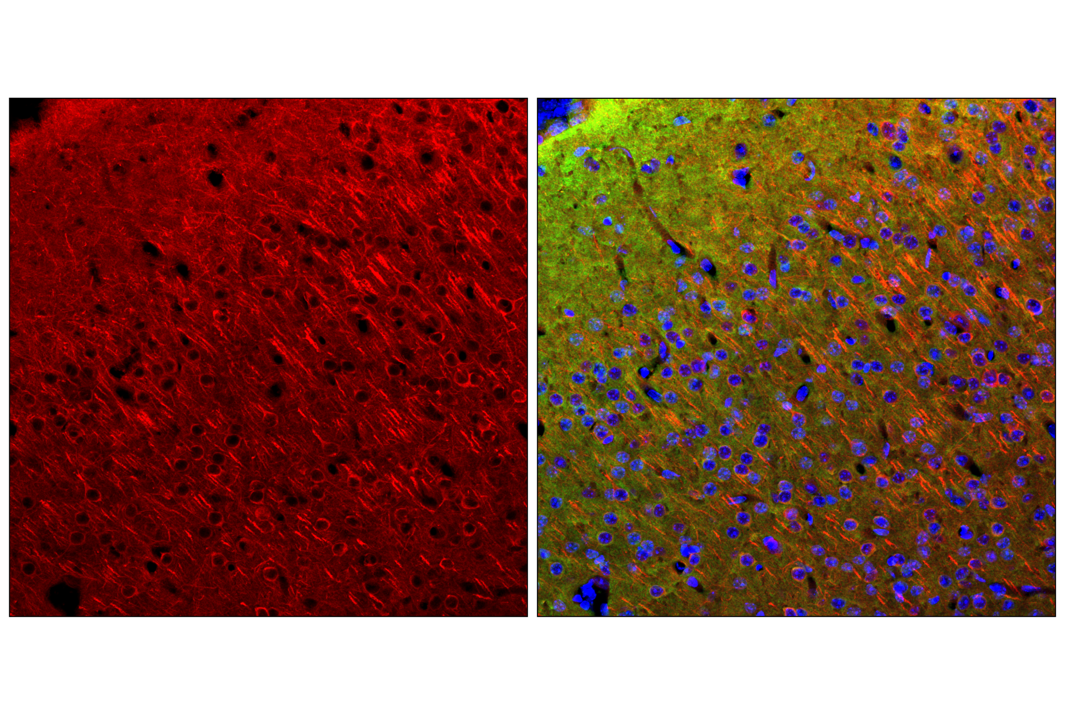 Immunofluorescence Image 2: β3-Tubulin (E9F3E) Mouse mAb (Alexa Fluor® 647 Conjugate)