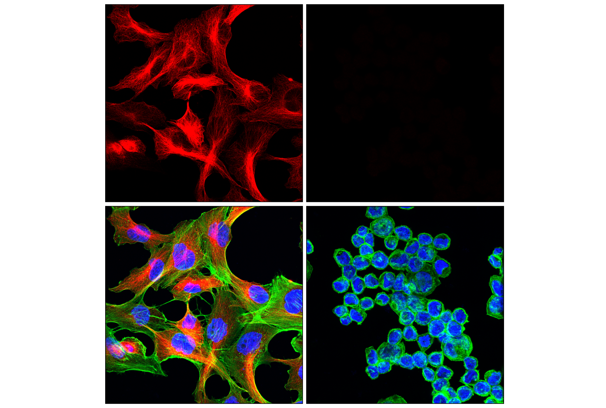 Immunofluorescence Image 3: β3-Tubulin (E9F3E) Mouse mAb (Alexa Fluor® 647 Conjugate)