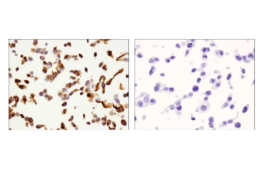 Immunohistochemistry Image 6: VISTA (D1L2G™) XP® Rabbit mAb (BSA and Azide Free)