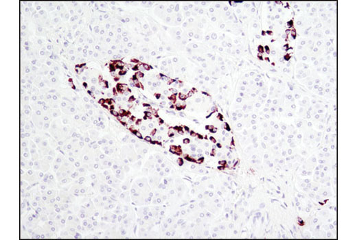  Image 9: Pancreatic Marker IHC Antibody Sampler Kit