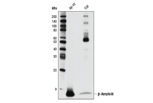  Image 22: β-Amyloid Mouse Model Neuronal Viability IF Antibody Sampler Kit