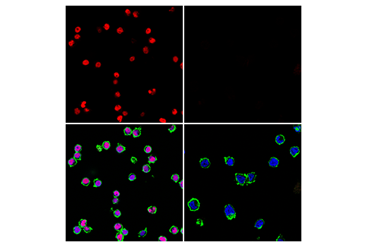 Immunofluorescence Image 4: Tox/Tox2 (E6G5O) Rabbit mAb (Alexa Fluor® 647 Conjugate)