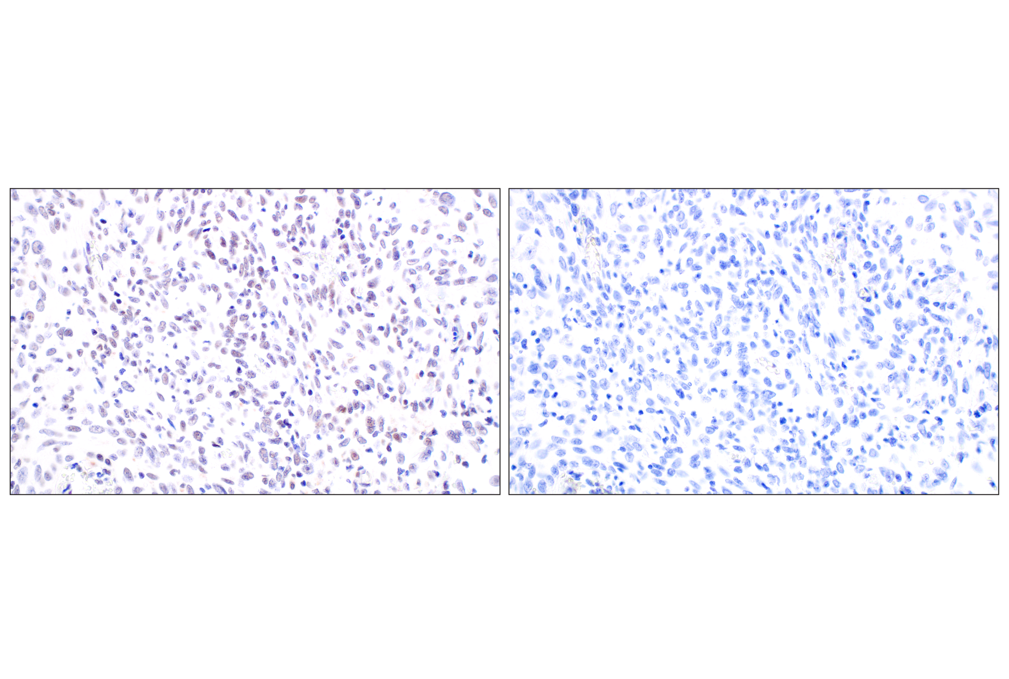 Immunohistochemistry Image 9: MDM2 (F7W7X) Rabbit mAb
