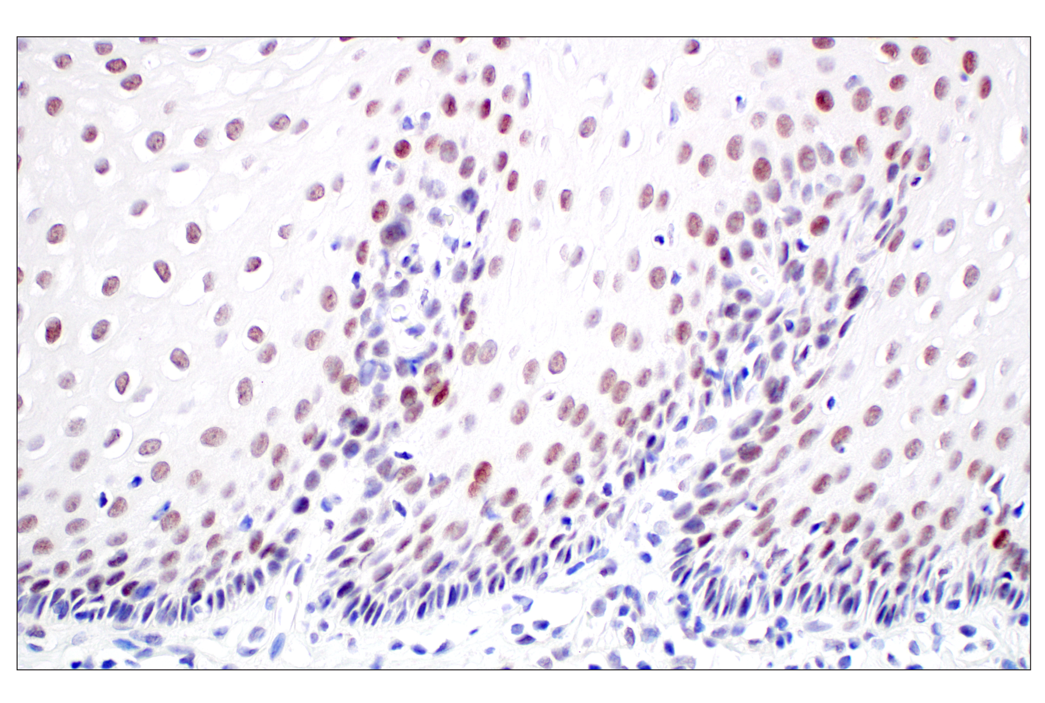 Immunohistochemistry Image 5: MDM2 (F7W7X) Rabbit mAb