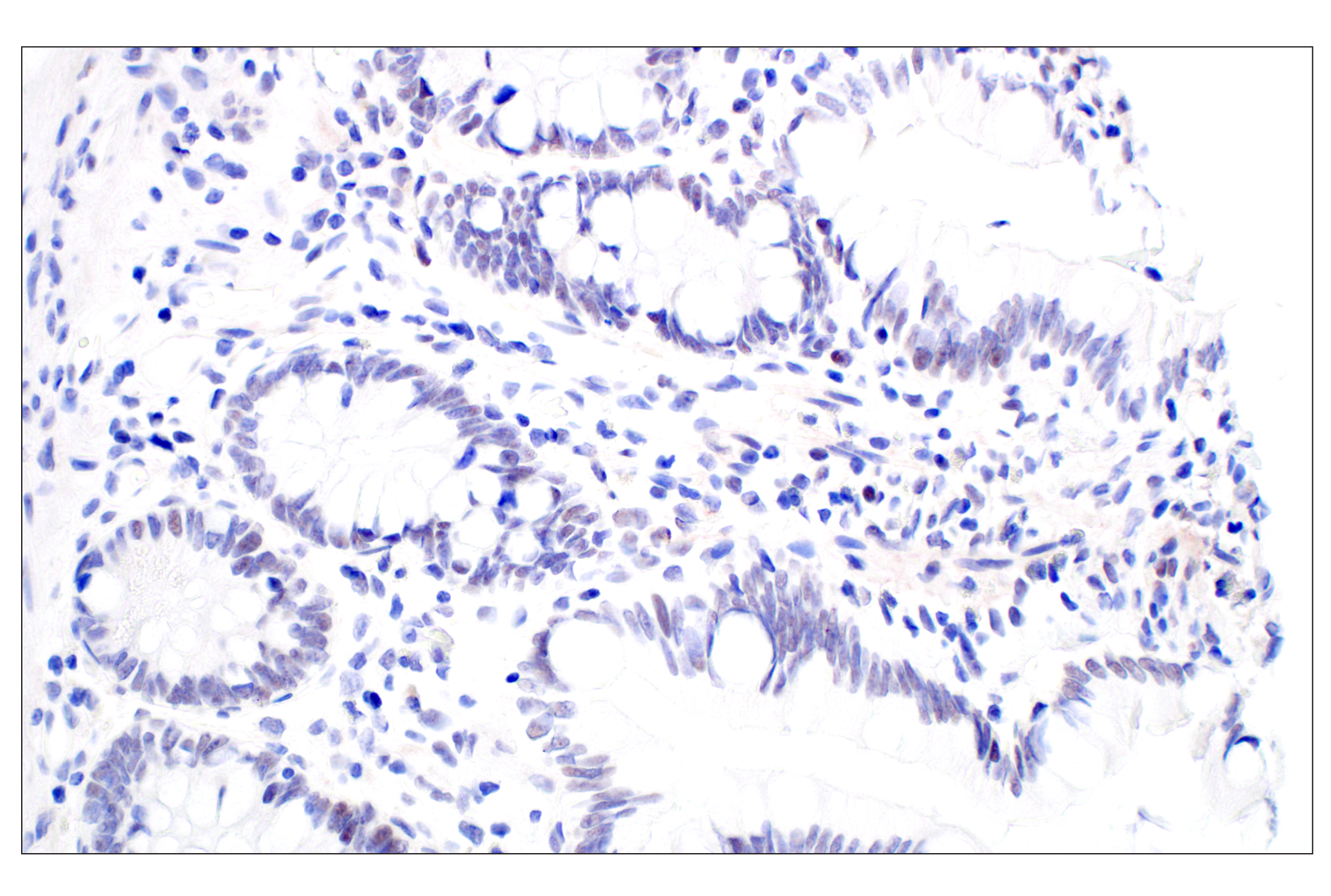Immunohistochemistry Image 7: MDM2 (F7W7X) Rabbit mAb