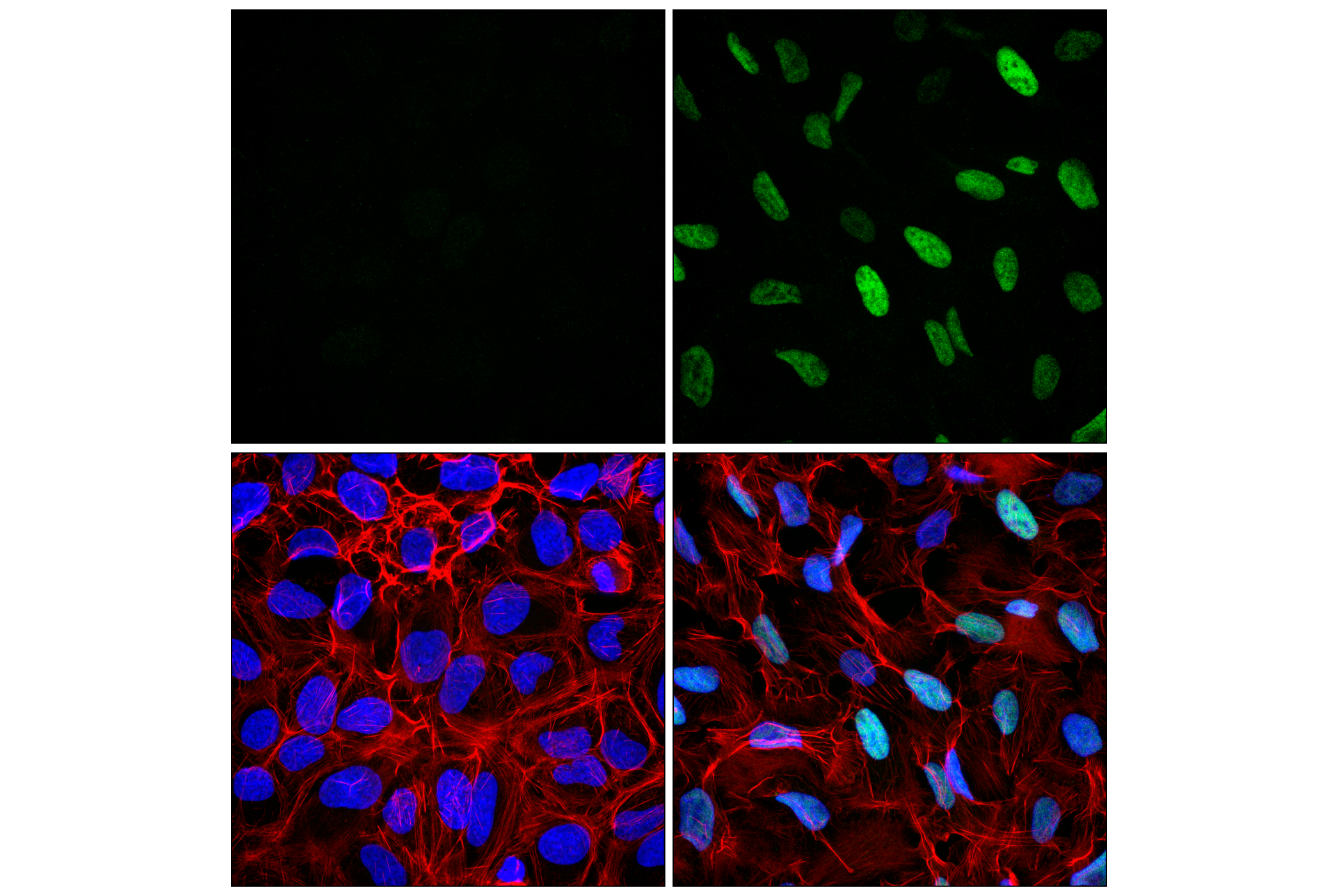 Immunofluorescence Image 1: MDM2 (F7W7X) Rabbit mAb